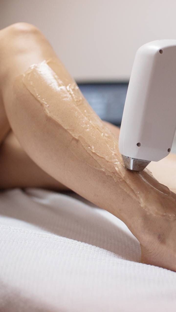 Epilation 1