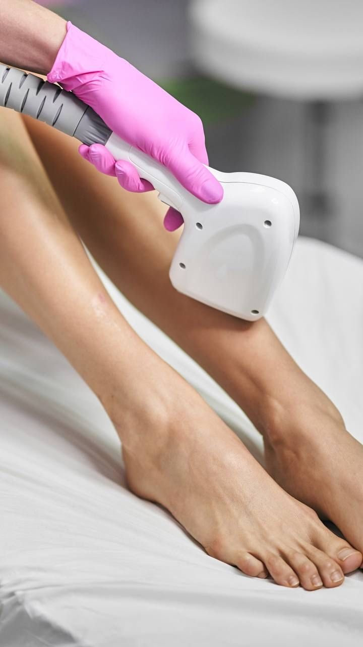 Epilation 4